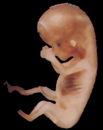 Foetus